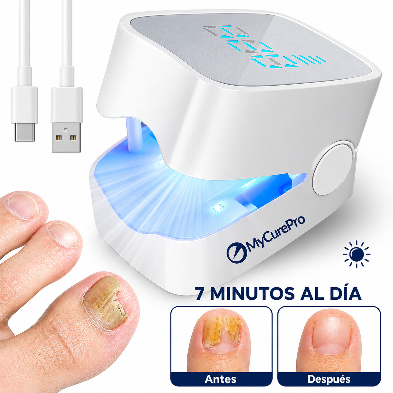 Dispositivo  Láser Antihongos para Uñas de Manos y Pies